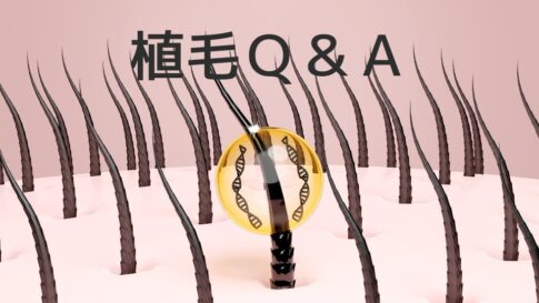 植毛Q＆A